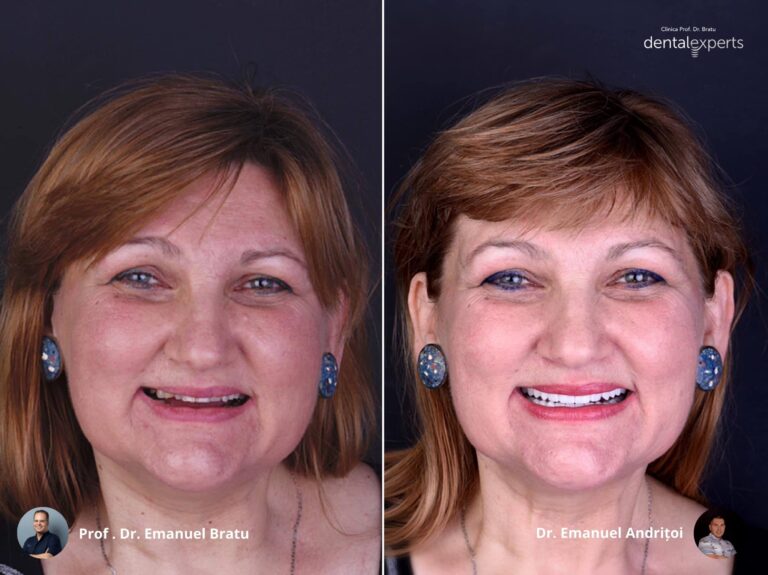https://dental.server-database.ro/wp-content/uploads/2026/06/carmen-ba.jpg