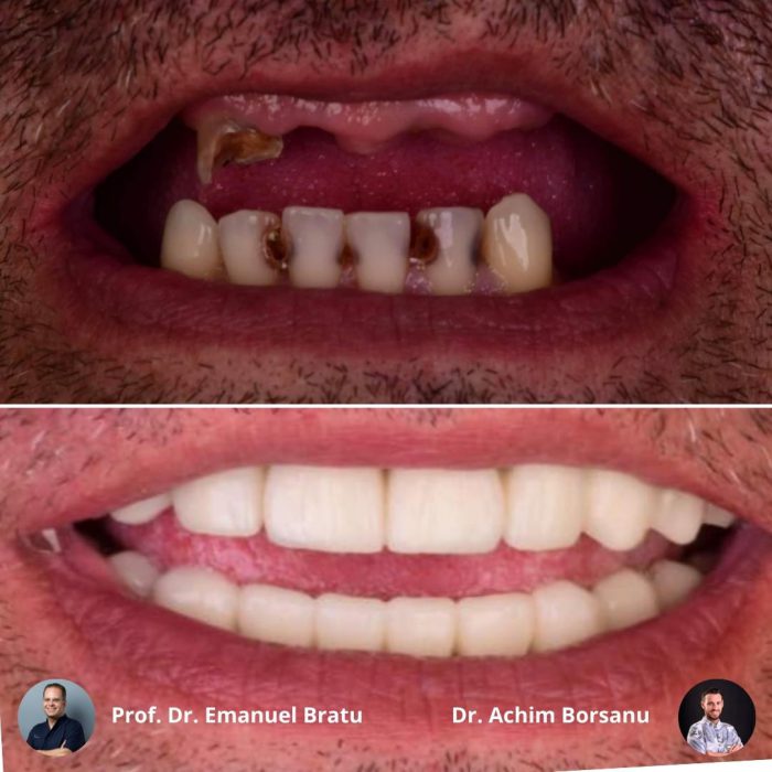 https://dental.server-database.ro/wp-content/uploads/2026/06/dan-ba.jpg