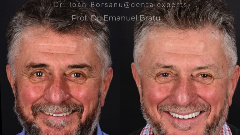 https://dental.server-database.ro/wp-content/uploads/2026/06/doru-ba.jpg