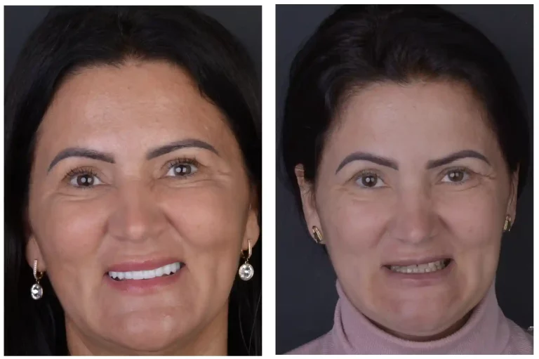 https://dental.server-database.ro/wp-content/uploads/2026/06/flori-ba.webp