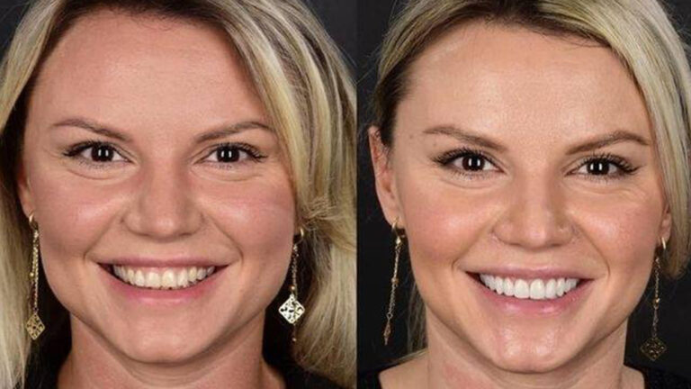https://dental.server-database.ro/wp-content/uploads/2026/06/iasmina-ba.jpg