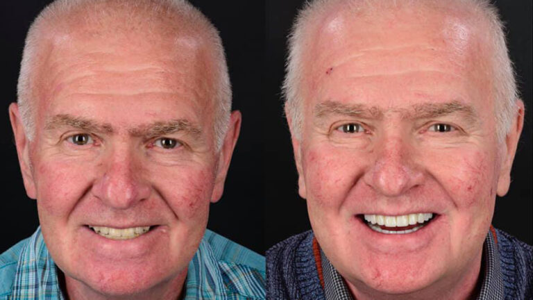 https://dental.server-database.ro/wp-content/uploads/2026/06/ioan-ba.jpg