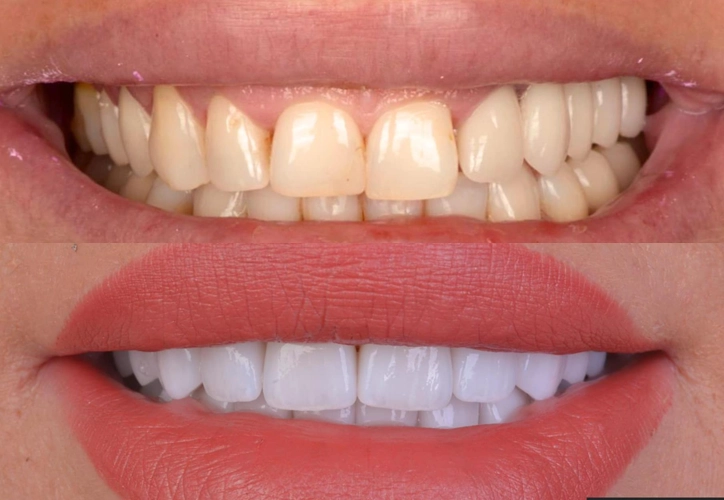 https://dental.server-database.ro/wp-content/uploads/2026/06/pacienta-9-1.webp